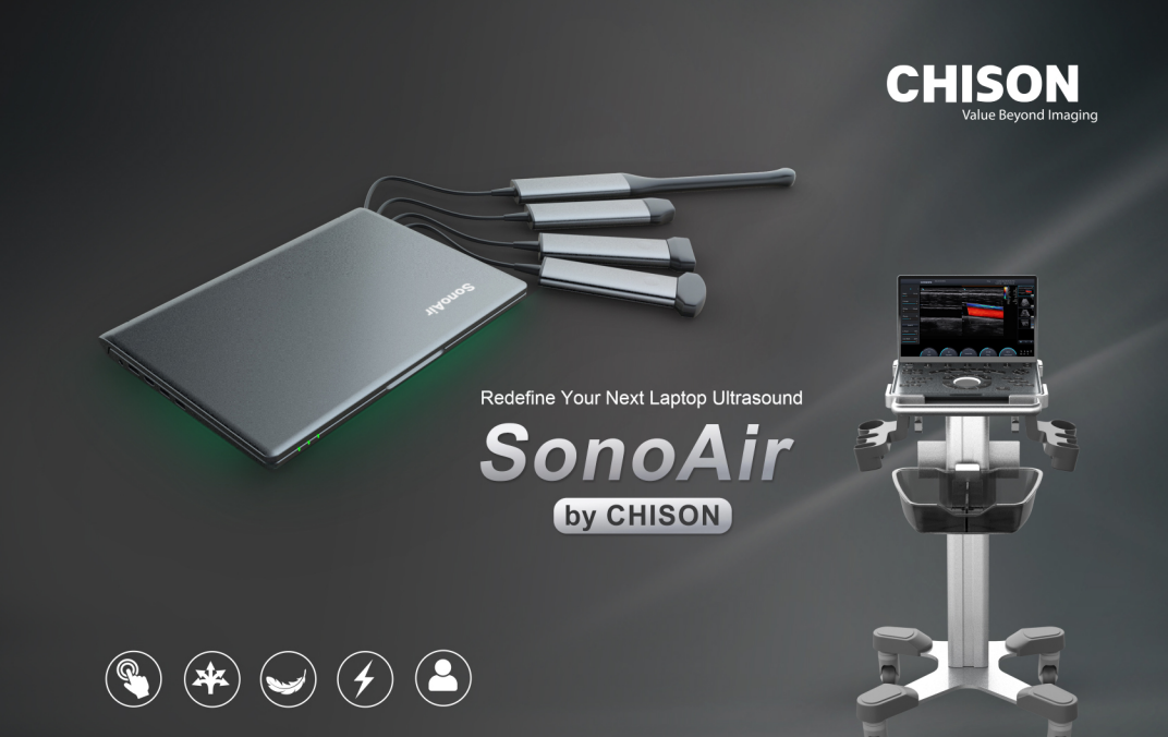 Echographe Portable .  CHISON SonoAir70