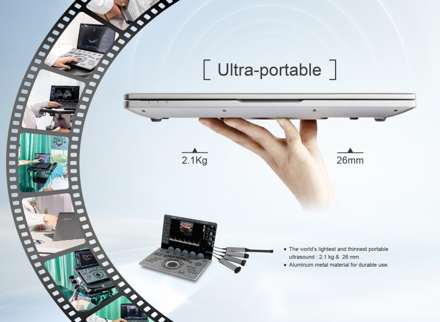 Echographe Portable .  CHISON SonoAir70