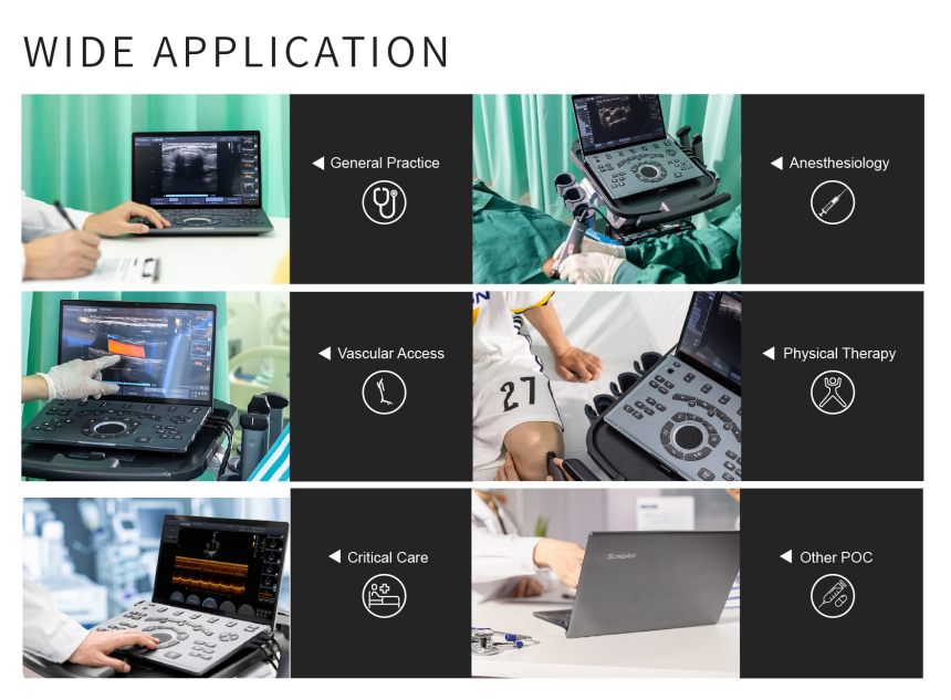 Echographe Portable .  CHISON SonoAir70