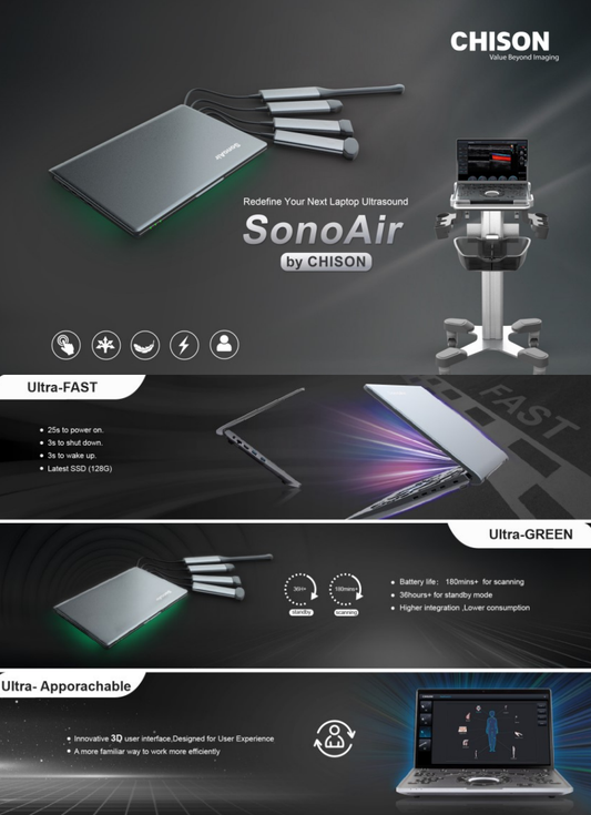 Echographe Portable .  CHISON SonoAir70