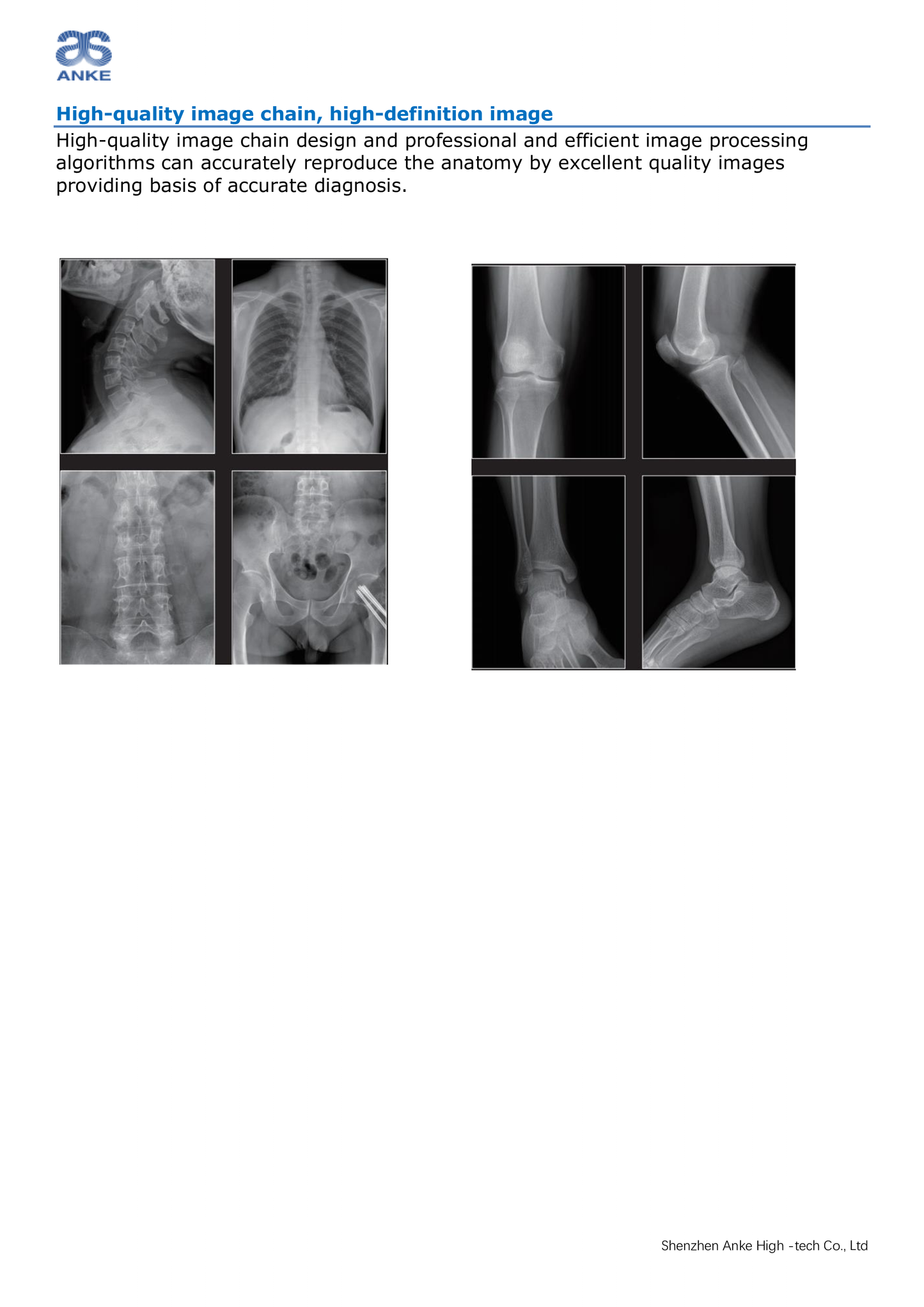 Radiographie Digitale  ANKE  ASR-6850P