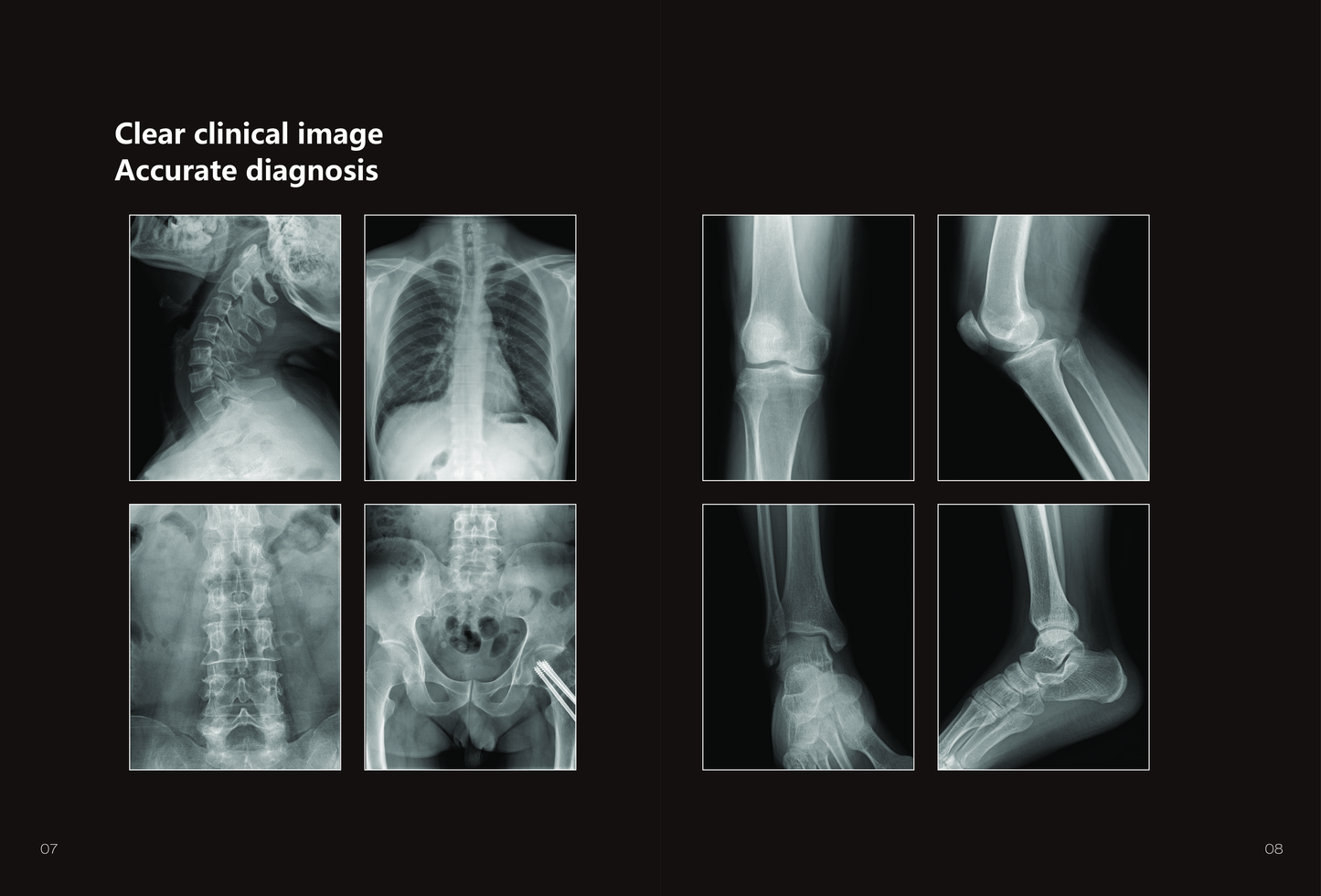 Radiographie Digitale  ANKE  ASR-6850P