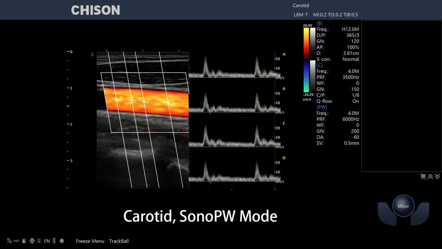 Echographe CHISON XBit90 . Haute Gamme